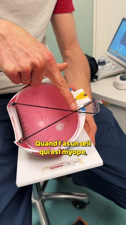 Myopie, hypermétropie c’est quoi? 👀 #sciences #yeux #fun