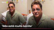 Leonardo sofre acidente e aparece com olho roxo nas redes sociais
