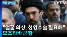 "얼굴에 심한 화상으로 성형수술 필요"...NYT가 보도한 모즈타바 근황 [지금이뉴스] / YTN