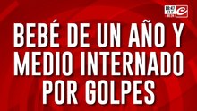 Golpeó salvajemente a bebé y le causó un derrame cerebral: está detenido