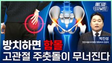 [메디컬 인사이트 133회] 방치하면 함몰되는 대퇴골두 무혈성 괴사의 증상과 치료법 / YTN