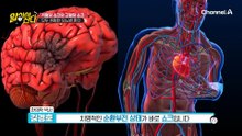 저혈당 쇼크가 부른 뇌경색, 22년 차 당뇨병 환자의 고백