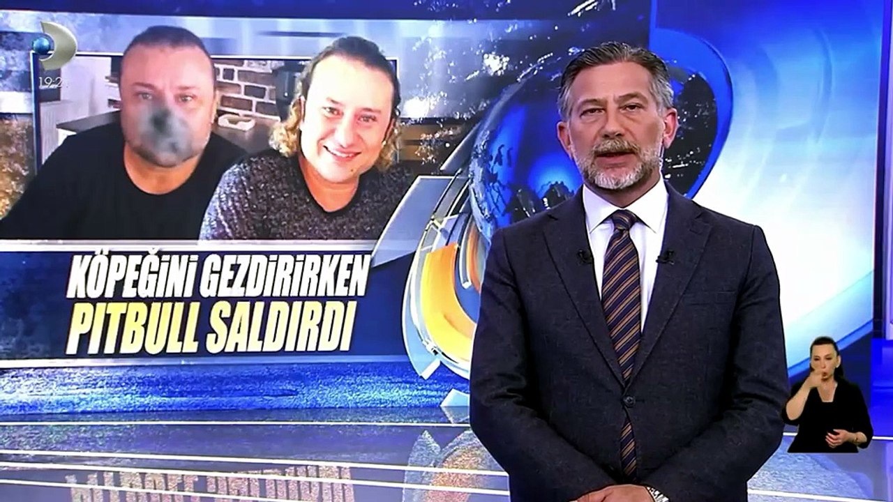 Onur Akay, pitbull saldırısını Kanal D Haber'e anlattı!