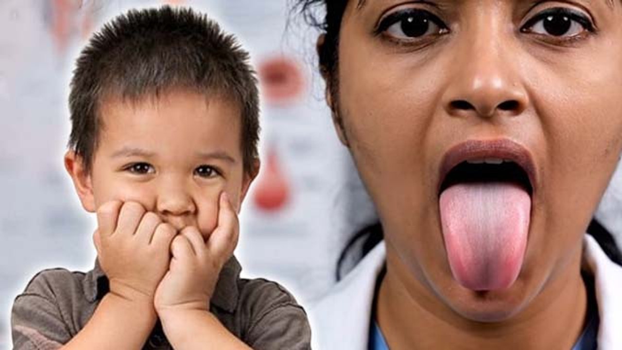 Bacche Ka Totlapan Kaise Theek Karen: बच्चे का तोतलापन कैसे ठीक करें | Lisping Treatment In Hindi