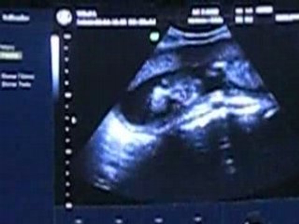 Nieto 10-06-2008