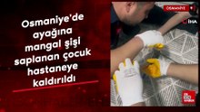 Osmaniye'de ayağına mangal şişi saplanan çocuk hastaneye kaldırıldı