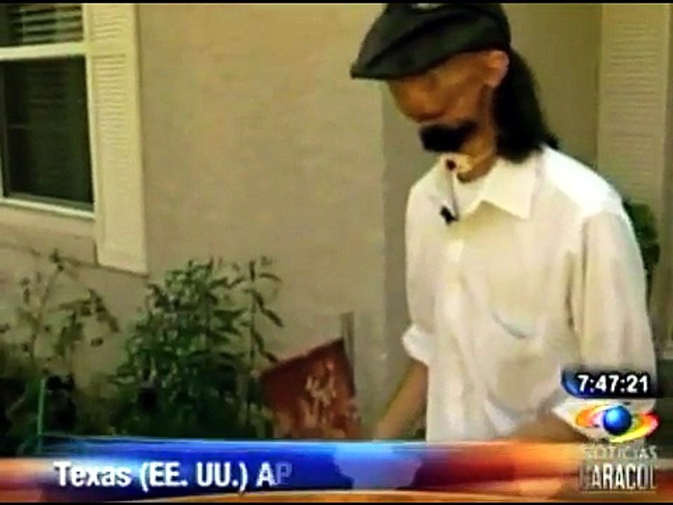 Hombre sin cara será operado