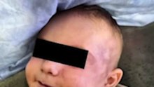 Escándalo y alarma en una guardería: una madre denunció que dejó a su bebé sano y se lo devolvieron brutalmente golpeado