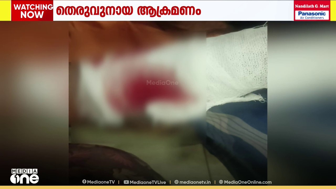 തിരുവനന്തപുരം വീരണകാവിൽ എട്ട് പേർക്ക് തെരുവുനായ...