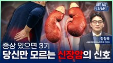 [메디컬 인사이트 134회] 증상 나타나면 3기? '신장암'의 증상과 치료법 / YTN