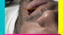 ¡CUCARACHA EN LA BOCA! El video más asqueroso que divide a internet