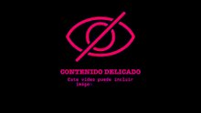 Conductor herido después de que su camión fuera atropellado por un avión