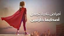 أمراض نادرة تجعل أصحابها خارقين