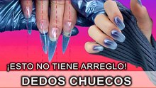 ¡Las uñas chuecas NO se pueden arreglar!