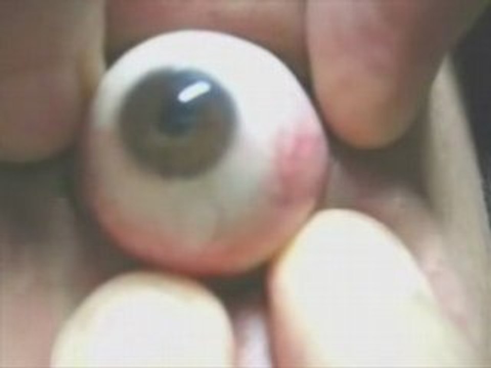 LesCretins.com - Il sort son oeil de son orbite !!