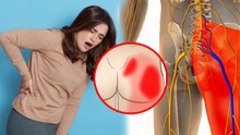 Sciatica Pain Relief: कूल्हे की नस दबने का कारण,लक्षण और इलाज | Hip Nerve Block Symptoms