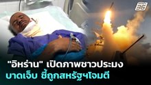 "อิหร่าน" เปิดภาพชาวประมงบาดเจ็บ ชี้ถูกสหรัฐฯโจมตี | เข้มข่าวค่ำ | 6 พ.ค. 69