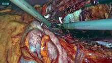 Surgeons: At the Edge of Life - Season 8 Episode 1 - Sacrifice to Survive