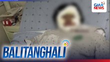 2 estudyante, nalapnos ang balat matapos masabuyan ng ethanol sa school laboratory | Balitanghali