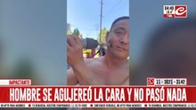 Intentó agujerearse la cara y sorprendió a todos. Mirá el video