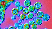 ¿Otra pandemia? Científicos revelan la verdad: Hantavirus vs. Covid-19
