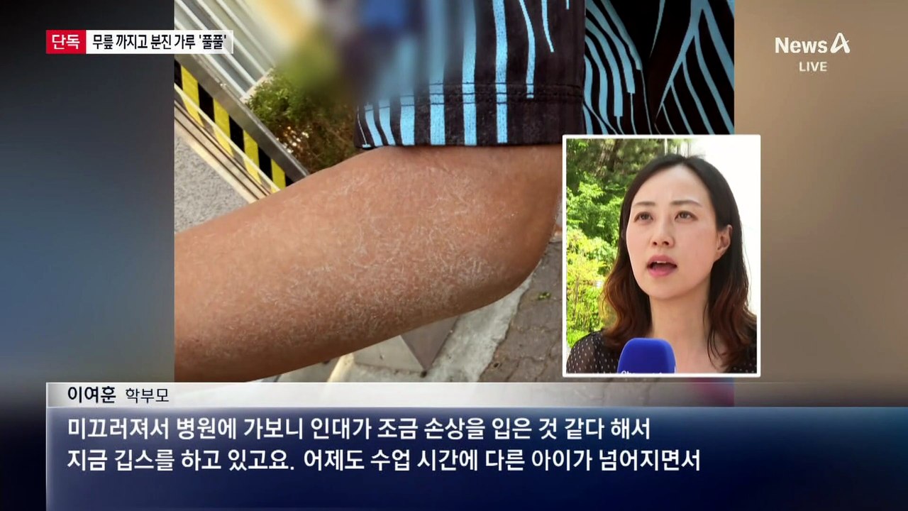 [단독]학교 운동장 잔디 16년 방치…깁스하는 아이들