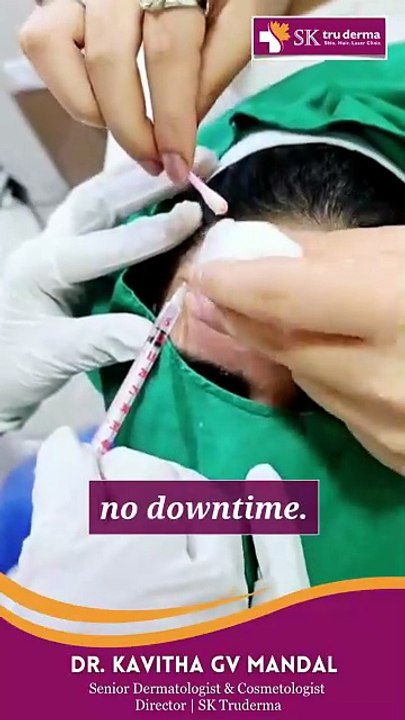 Rating Anti-Agenig Treatments - Expert Dermatologist in Bangalore Reveals the Truth - SK Truderma