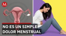 La alarmante razón por la que miles de mujeres sufren endometriosis sin saberlo
