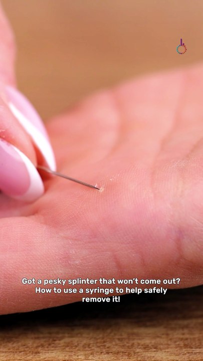 Easy way to remove a stuck splinter