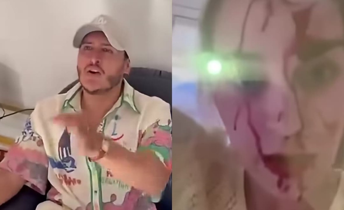 Así fue la salvaje golpiza del estilista venezolano a la Miss Venezuela Global