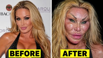 Celebrity Plastic Surgery Disasters