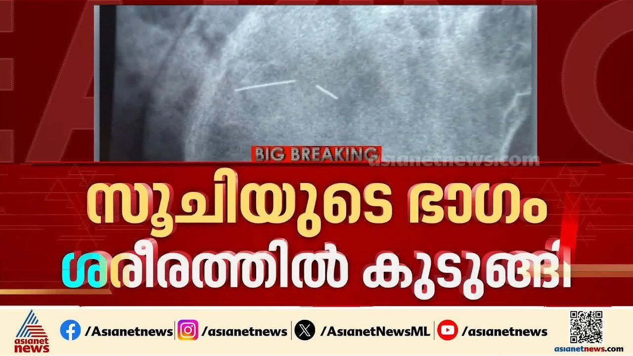 സൂചിയുടെ ഭാഗം ശരീരത്തിൽ കുടുങ്ങി; ആശുപത്രിക്കെത...
