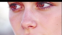 Rosacea | Types of acne | Health | World Explorer