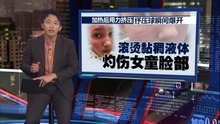 女童脸上炸出长伤痕，恐永久留疤   女童母亲: 幸好没喷进女儿眼睛