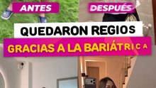 Famosos que quedaron regios gracias a la bariátrica