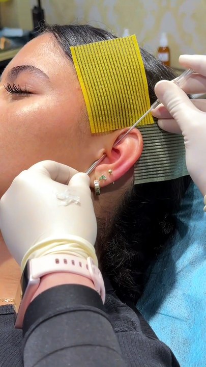 One Needle, One Big Surprise: My Daith Piercing Story from Start to Now #daithpiercing #earpiercing