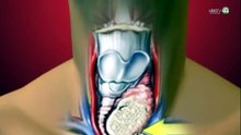 Problemas de tiroides crecen en México; ya compiten con enfermedades como la diabetes