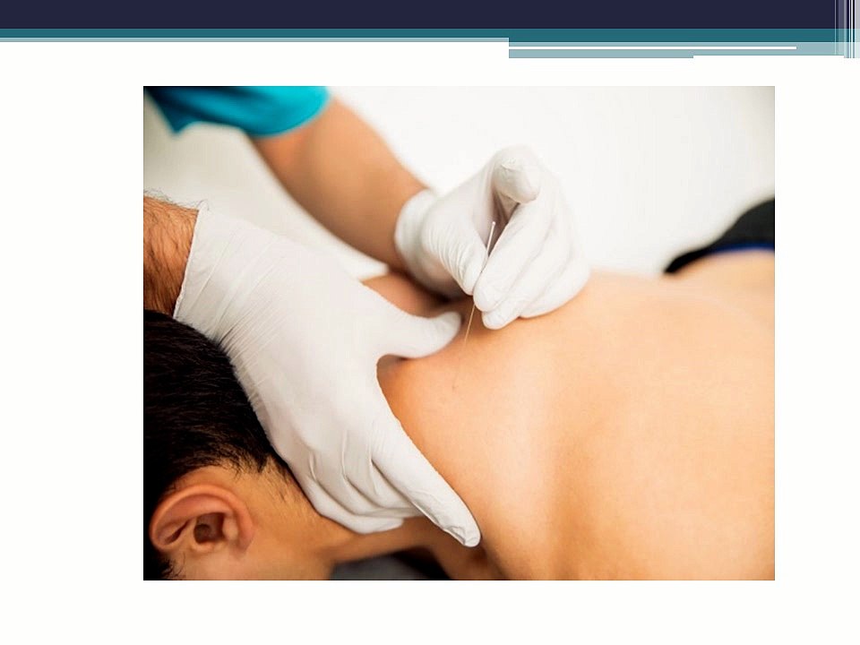 Why More Individuals Are Turning to Acupuncture Treatment In Finch for Natural Recovery and Pain Relief