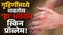 गृहिणींनो, त्वचेच्या समस्यांकडे दुर्लक्ष करू नका | Skin Care for Housewives