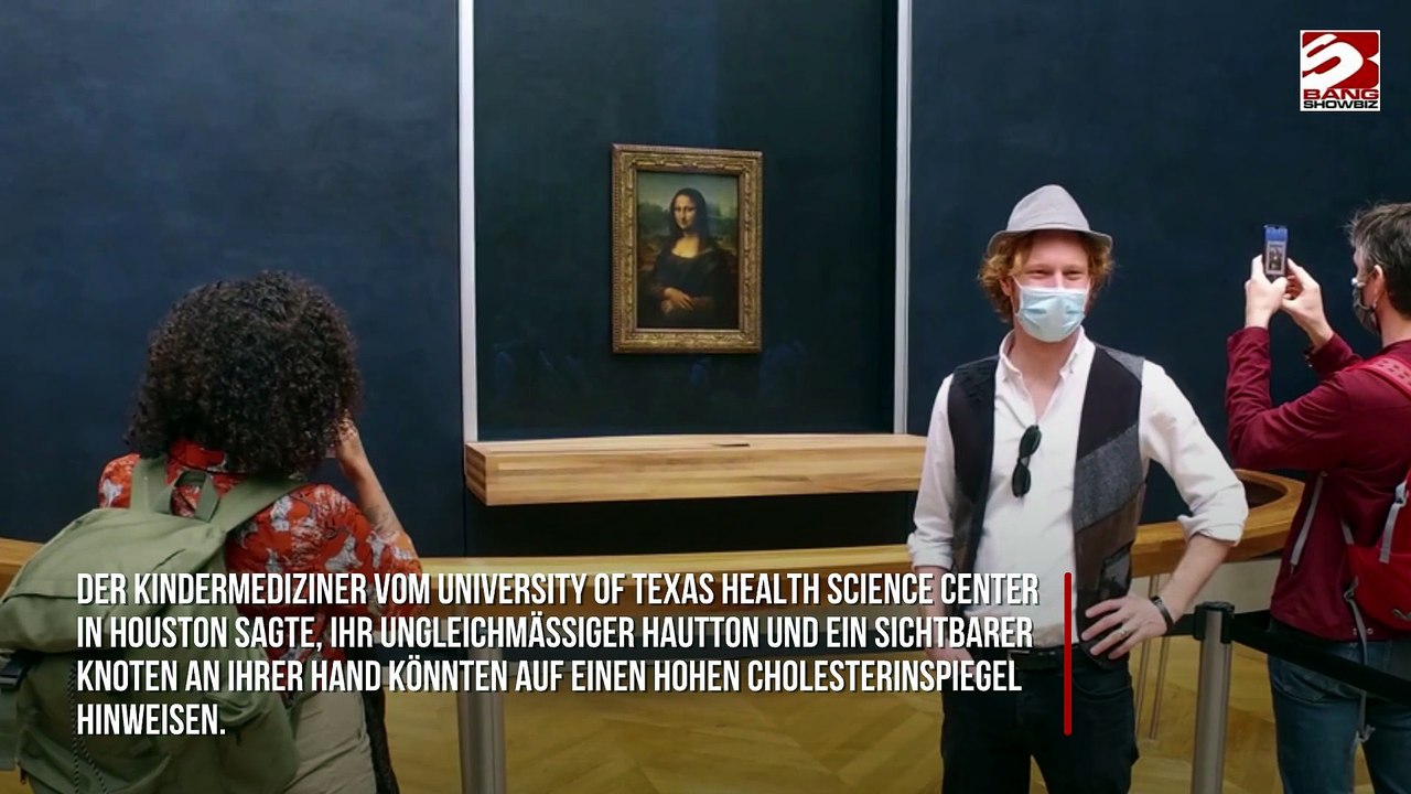 Die Mona Lisa könnte unter Fettleibigkeit und hohem Cholesterin gelitten haben, behauptet Arzt
