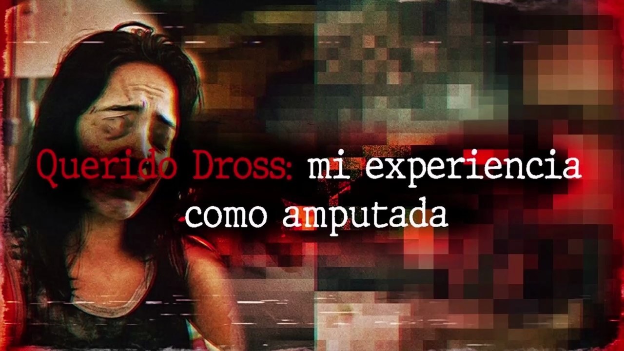 Querido Dross mi experiencia como amputada