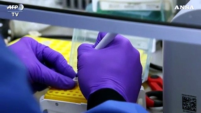 Covid, AstraZeneca: temporaneo stop nei test del vaccino Oxford