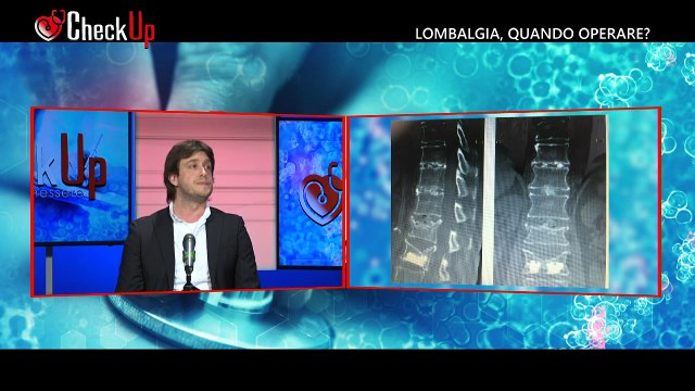 LOMBALGIA, QUANDO OPERARE? del 10-05-23 | LOMBALGIA, QUANDO OPERARE? del 10-05-23