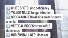 YOUR NAILS ARE WARNING YOU