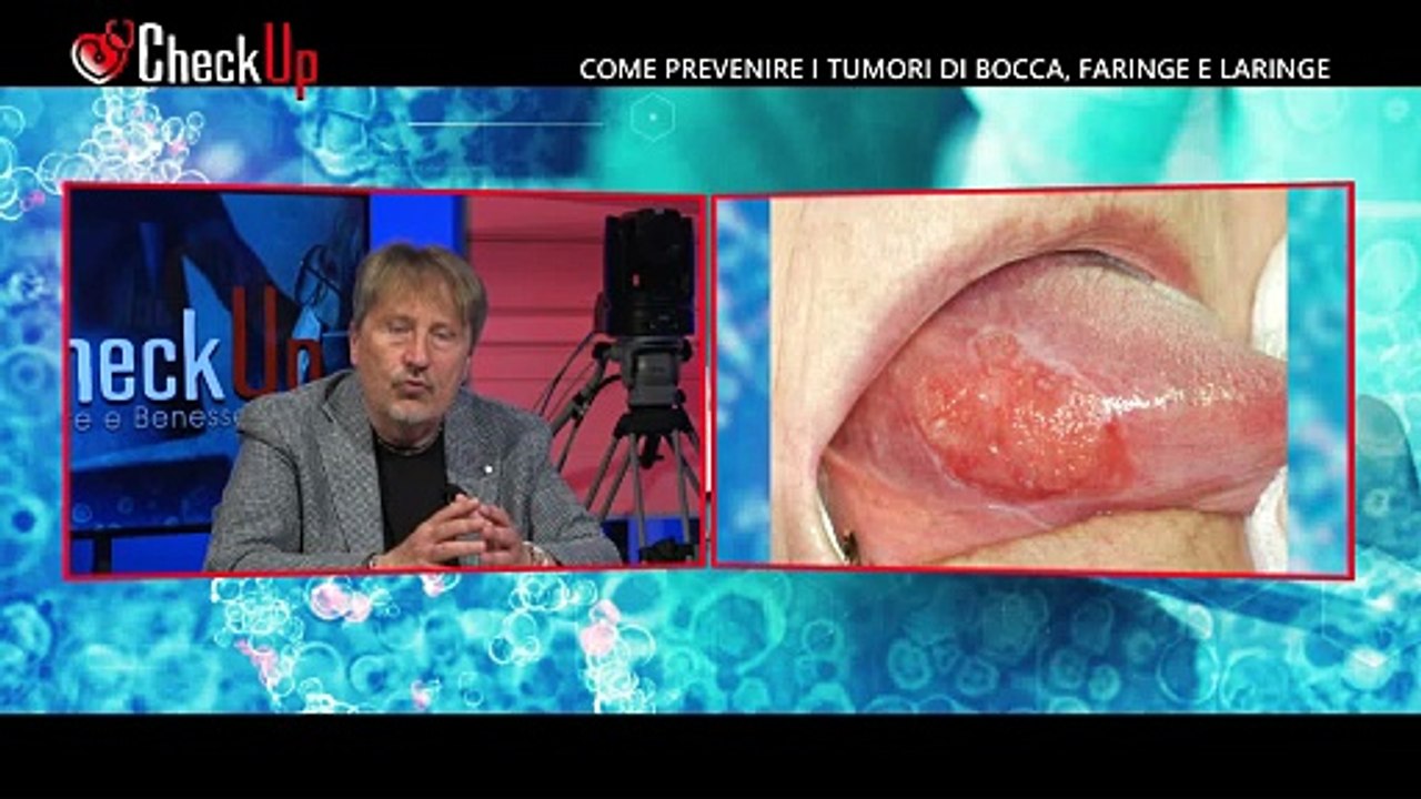 Check-Up "Come prevenire i tumori di bocca, faringe e laringe" del 15-05-24 | Check-Up "Come prevenire i tumori di bocca, faringe e laringe" del 15-05-24