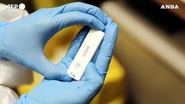 Meno casi, ma tamponi dimezzati da novembre