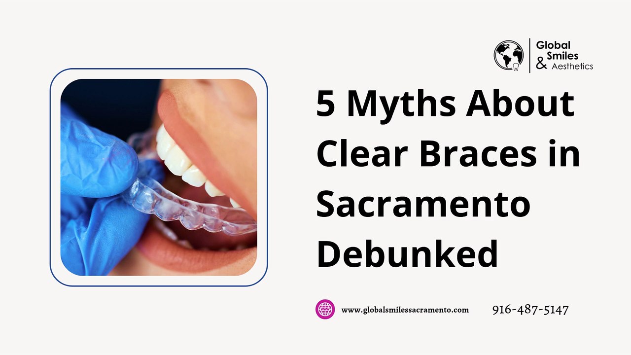 5 Myths About Clear Braces in Sacramento Debunked