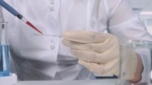 Blood test study raises hopes for earlier Alzheimer's detection