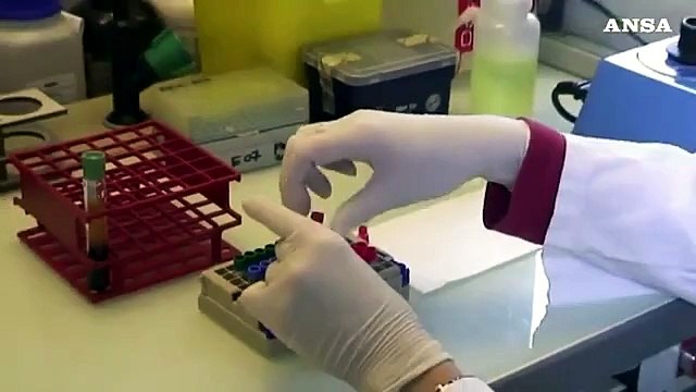 Tumore ovaio, scoperto meccanismo-chiave per la crescita