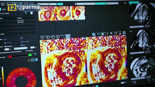 SALUTE NEWS : STASERA ALLE 21 SU 12 TV PARMA SI PARLA DI CARDIOLOGIA PERSONALIZZATA | SALUTE NEWS : STASERA ALLE 21 SU 12 TV PARMA SI PARLA DI CARDIOLOGIA PERSONALIZZATA